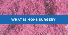 Mohs-MD - Dermatologic Surgery Center of Washington